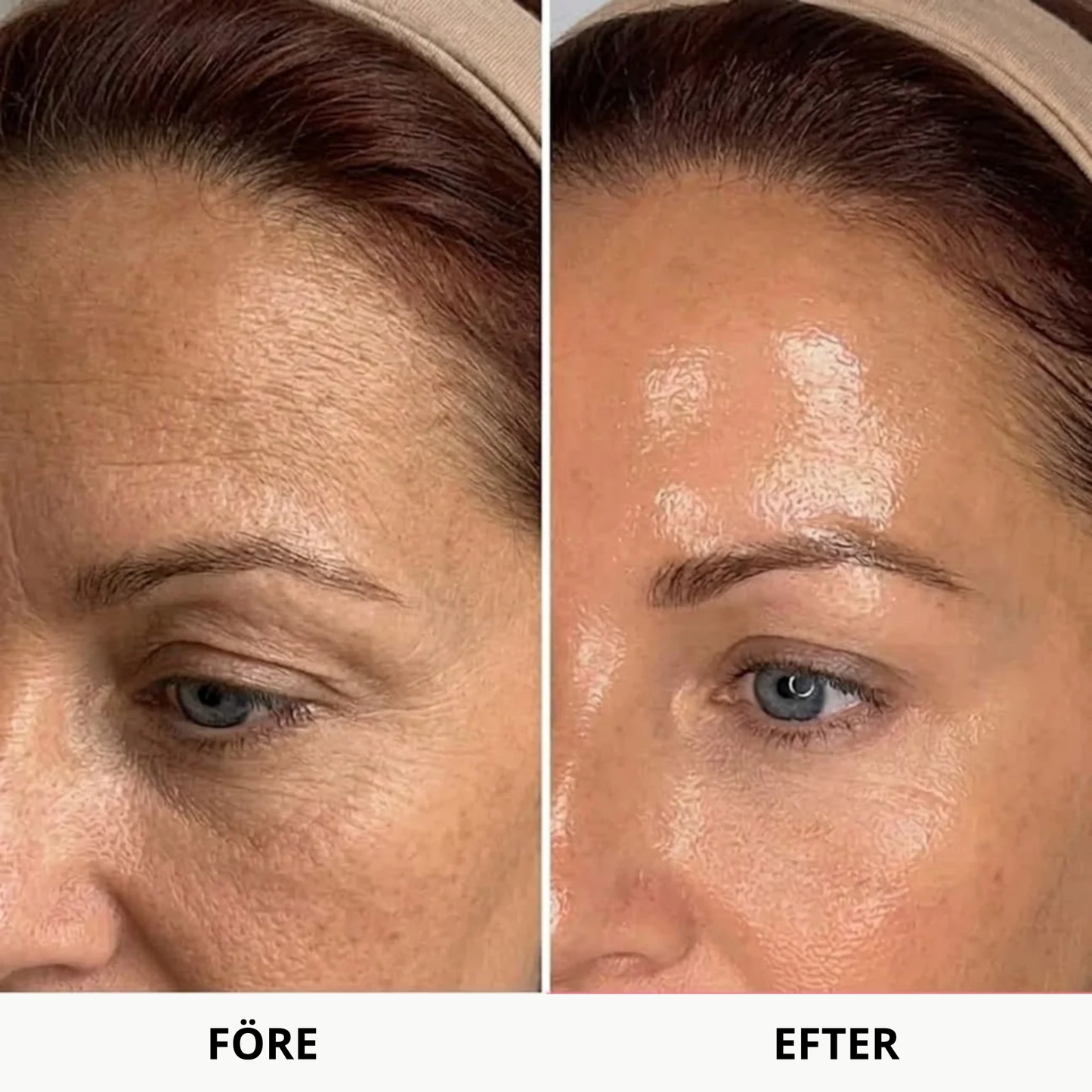 PDRN Collagen Volume