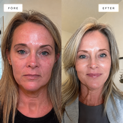 PDRN Collagen Volume