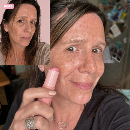 PDRN Collagen Volume